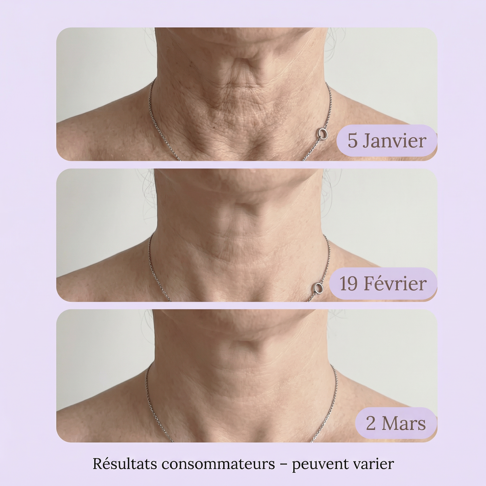 Bouclier Dermo-Reconstructeur Cou & Décolleté Nelaya